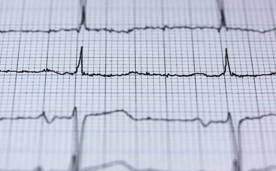 Ischemic Heart Disease